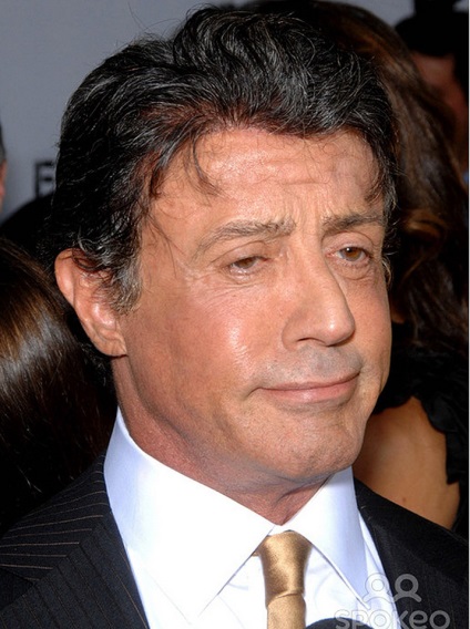 Plastic Sylvester Stallone (Sylvester Stallone chirurgie plastica) Plastic Sylvester Stallone