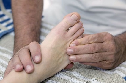 Simptomele și tratamentul gutei, simptomele acelei boli, modul de a trata guta (simptome) simptome de tratament, guta si simptomele pe care boala, modul de a trata guta