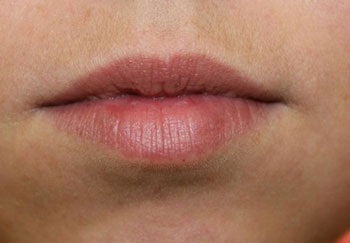 Pompa pentru marirea buzelor (foto) comentarii, video cum să folosească mâinile sale, în cazul în care pentru a cumpăra cele mai bune (mâini) Pompa pentru marirea buzelor (foto) comentarii, video cum să folosească mâinile sale, în cazul în care pentru a cumpăra cele mai bune