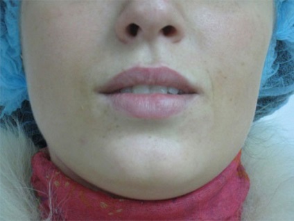 Pompa pentru marirea buzelor (foto) comentarii, video cum să folosească mâinile sale, în cazul în care pentru a cumpăra cea mai bună (utilizare) Pompa pentru marirea buzelor (foto) comentarii, video cum să folosească mâinile sale, în cazul în care pentru a cumpăra cele mai bune