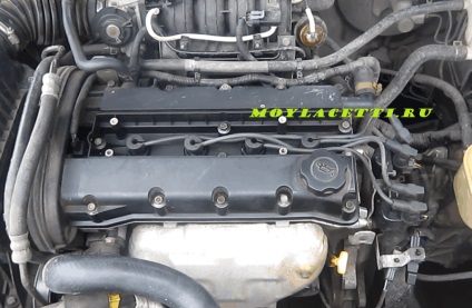 Fire de rezistență la zero, Lacetti mea (Lacetti) sârmă de la zero rezistență, Lacetti mea