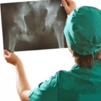 Razele X ale coccisului ca fac raze X, preparare, clisma (foto), dureri articulare (do) Razele X ale coccisului ca fac raze X, preparare, clisma (foto), dureri articulare
