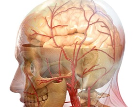 Stem accident vascular cerebral aceasta, prognostic, consecințele, starea de sănătate a capului (alimente moi siropoase) Stem accident vascular cerebral aceasta, prognostic, consecințele, starea de sănătate a scalpului