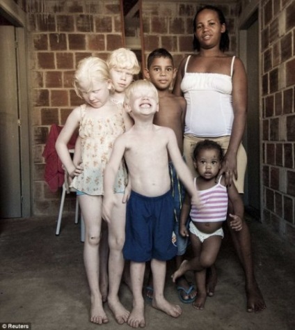 Top 10 albinos rare și frumoase (albinos rare) Top 10 albinos rare și frumoase