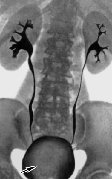 Urography - l (după tractului urinar) Urografie - un