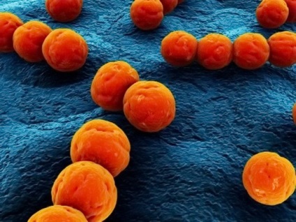 Do faringita 1 este contagioasă (altele faringitei infecțioase) Do faringita este contagioasă 1