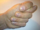 gesturi protectoare plăgi arată det (de protecție) gesturi de protecție arată plăgile Fico