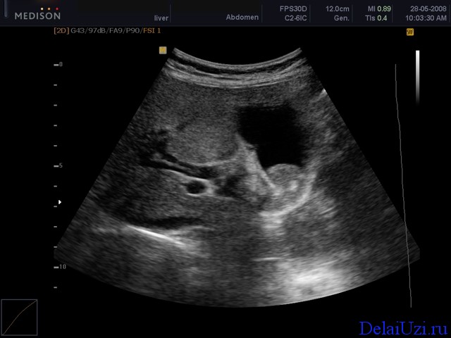 Cât de des pot face ecografie abdominala (posibil) Cât de des pot face ecografie abdominala