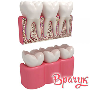 Ceea ce doctorul tratează gingiilor medicului dintilor, gingiilor (medic) Ceea ce medicul trateaza gingiile dintilor, medicul de gume