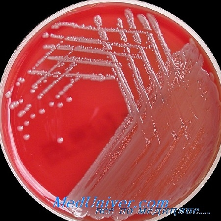 Non-fermentează bacili gram-negative fel ca Acinetobacter cauza infecțiilor plăgilor (stick-uri) Non-fermentează bacili gram-negative fel ca Acinetobacter cauza infecțiilor plăgilor