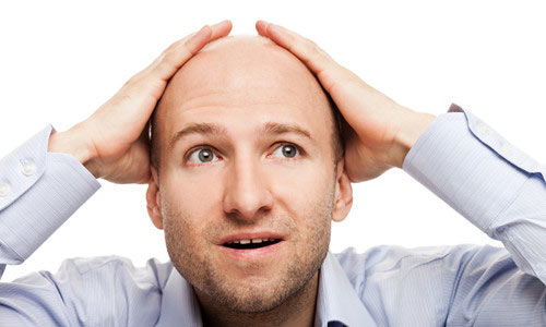Tratamentul alopecia areata în diagnosticul barbati (alopecie de tratament alopecia areata bărbați) Alopecia areata tratament barbati, diagnostic