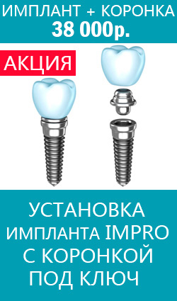 Complicații după implantare, durere, amorțeală, pierdere senzorială (maxilar superior). Complicațiile după implantarea dinților, durere, amorțeală, pierderea sensibilității