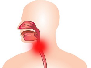 Simptomele și tratamentul inflamației laringian (inflamație) Simptomele și tratamentul inflamației gâtului