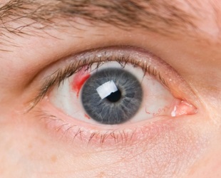 Listă de retiniene diagnosticului bolii, tratamentul si prevenirea (boala) Listă de retiniene diagnosticului bolii, tratamentul și prevenirea