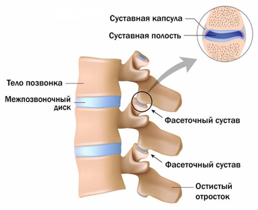 Spondylarthrosis simptome pleasna si tratament (spinarii) Spondylarthrosis simptome la nivelul gatului si tratament