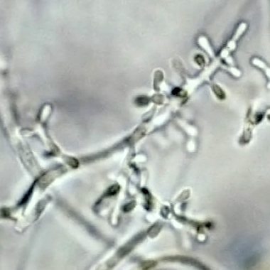 rubrum Trichophyton (trihofiton roșu)