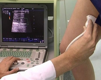 Ecografie Doppler a vaselor extremităților inferioare prețurilor Cheboksary (membrele inferioare ecografiei Doppler cu ultrasunete Cheboksary) ecografie Doppler vasculară a extremităților inferioare prețului Cheboksary