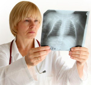 Bronșită (inflamație a epuizării bronhiilor) inflamația bronhiilor