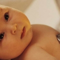 Alergia - cum de a trata alergii, articol despre diferitele tipuri de reacții alergice (alergie) Alergia - cum pentru tratarea alergiilor, articolul despre diferitele tipuri de reacții alergice