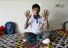 American a murit de infectie, care nu au putut face fata nici un antibiotic ina (smog) American a murit de infectie, care nu au putut face fata nici un ins antibiotice