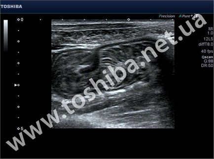 masina cu ultrasunete, prețul (disponibil Aplio Aplio500) masina cu ultrasunete, prețul