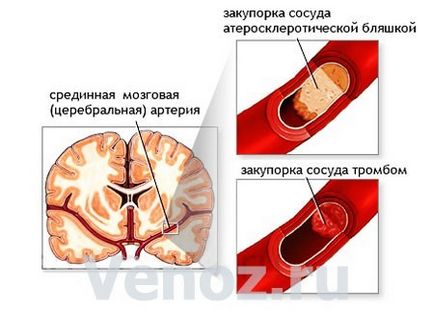 Boli ale capului și creierului (bolii) Boli ale capului și creierului
