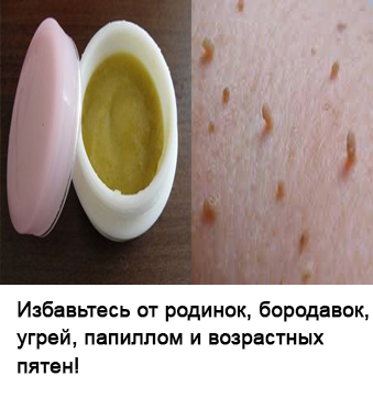 Fiți atenți atunci când doare în abdomen din stânga sus! A se vedea o durere completă în zona hărții (fie) Fiți atenți atunci când doare în abdomen din stânga sus! A se vedea o durere completă în zona de pe hartă