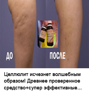 Fiți atenți atunci când doare în abdomen din stânga sus! A se vedea o durere completă în zona de pe hartă (partea de sus) Fiți atenți atunci când doare în abdomen din stânga sus! A se vedea o durere completă în zona de pe hartă