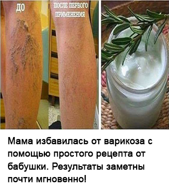 Fiți atenți atunci când doare în abdomen din stânga sus! A se vedea o durere completă în zona hărții (fie) Fiți atenți atunci când doare în abdomen din stânga sus! A se vedea o durere completă în zona de pe hartă