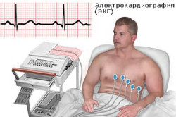 Hipertrofia periculoasă a ventriculului stâng (inima) Hipertrofia periculoasă a ventriculului stâng
