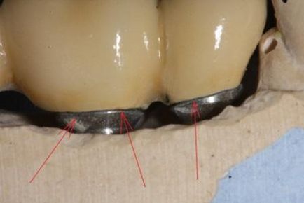Implanturile dentare în întrebări și răspunsuri (dinți) implanturi dentare întrebări și răspunsuri