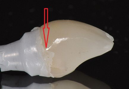 Implanturile dentare în întrebări și răspunsuri (Chestiuni) implanturi dentare întrebări și răspunsuri