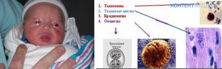 Ca metode transferate infecție toxoplasmoză și perioada de incubare (transmise) Ca metode transferate infecție toxoplasmoză și perioada de incubare