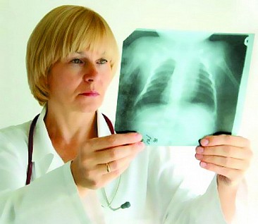 Tuse după pneumonie (inhalare) Tuse dupa pneumonie