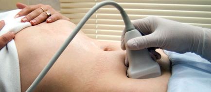 Luteale simptome ovarian chist si tratament (chist) Luteale simptome chist ovarian si tratament
