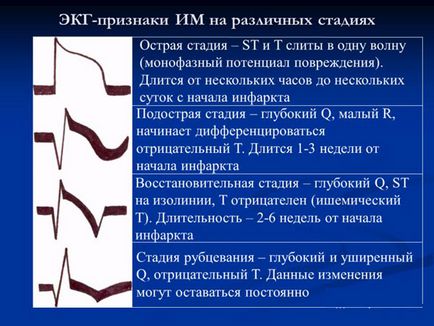 infarct miocardic focal - un vast, cauze, simptome, tratament, difuz (extensiv) infarct miocardic focal - un vast, cauze, simptome, tratament, difuz