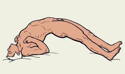 Opistotonus - l (înclinarea capului din spate) Opistotonus - l
