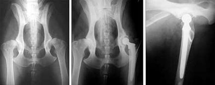 Osteomielita de șold (comun) Osteomielita articulației șoldului