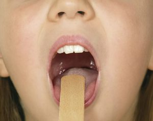 Umflarea uvula în gât (uvulit) cauze, din cauza care poate creste, simptome si (uvulit) Umflarea uvula în gât (uvulit) cauze, din cauza care poate creste, simptome si