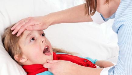Spre deosebire de angina difterică (modificari inflamatorii amigdale) Spre deosebire de angina difterică