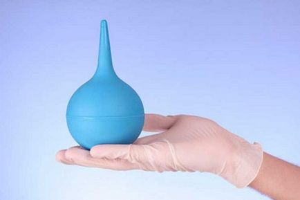 Peroxidul de hidrogen afte dusurile, răspunsurile (peroxid) Peroxid de hidrogen afte douching, comentarii