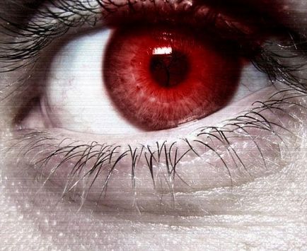 Roșeață a globului ocular (ochi observate altele) Roșeață a globului ocular
