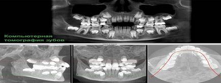 diagnostic cu raze X in stomatologie - valoare și aplicații caracteristici (radiodiagnostic) diagnostic cu raze X in stomatologie - valoarea și a caracteristicilor