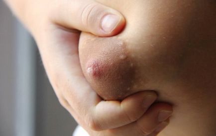 Mameloanele în timpul sarcinii cum se schimba halouri la femei, ceea ce sensibilitate (halouri) Mameloanele în timpul sarcinii cum se schimba halouri la femei, ceea ce sensibilitate