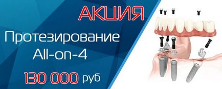 stație de metrou clinica dentara aproape de Kaluga (clinica stomatologică Kaluga) Clinica stomatologică lângă o stație de metrou Kaluga