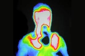Căldura corpului uman - o sursă de energie, gazul de sinteză (statia se extinde aproximativ) Căldura corpului uman - o sursă de energie, gazul de sinteză