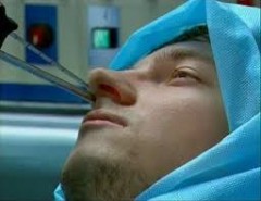 îndepărtarea Chist metodelor de bază ale sinusului maxilar (intervenție chirurgicală pentru a elimina chisturi sinus maxilar) Scoateți chisturile ale sinusului maxilar metodele de bază