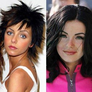 Creșterea buza înainte și după (cosmetician Elvira Bredneva) Creșterea buza înainte și după
