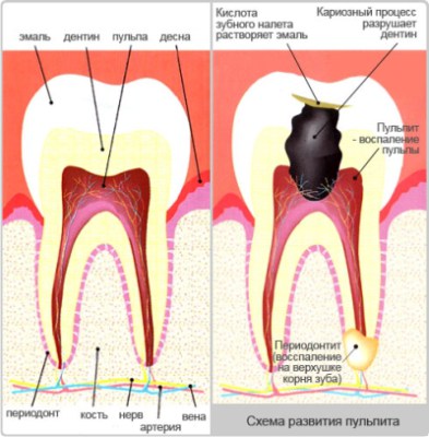 Boli ale dinților, gingiilor și remedii populare pentru durere de dinți, sănătate și longevitate regula (remedii populare) dentare boli ale gingiilor și remedii populare pentru reguli dureri de dinți, sănătate și longevitate