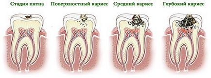Boli ale dinților, gingiilor și remedii populare pentru durere de dinți, sănătate și longevitate (regula dinții și boli ale gingiilor) dentare boli ale gingiilor și remedii populare pentru reguli dureri de dinți, sănătate și longevitate